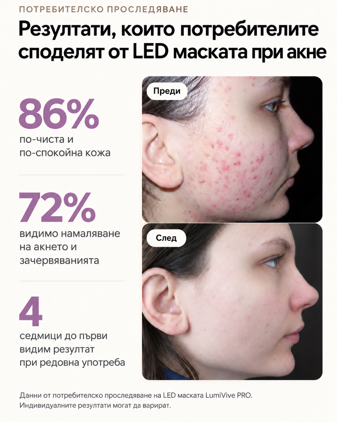 Μάσκα LED LumiVive™