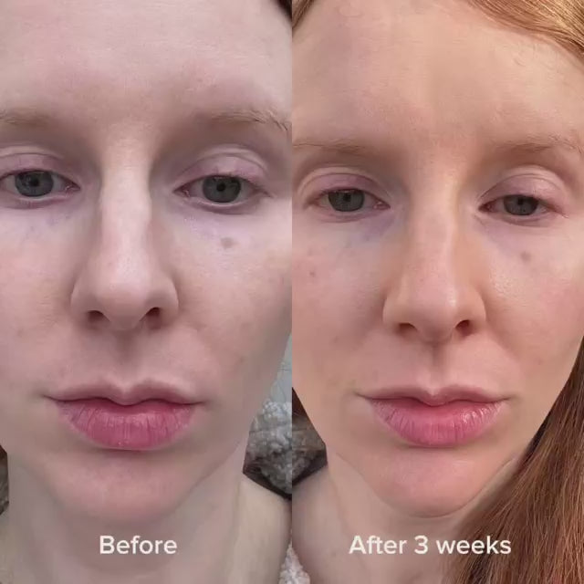 Φόρτωση βίντεο: 